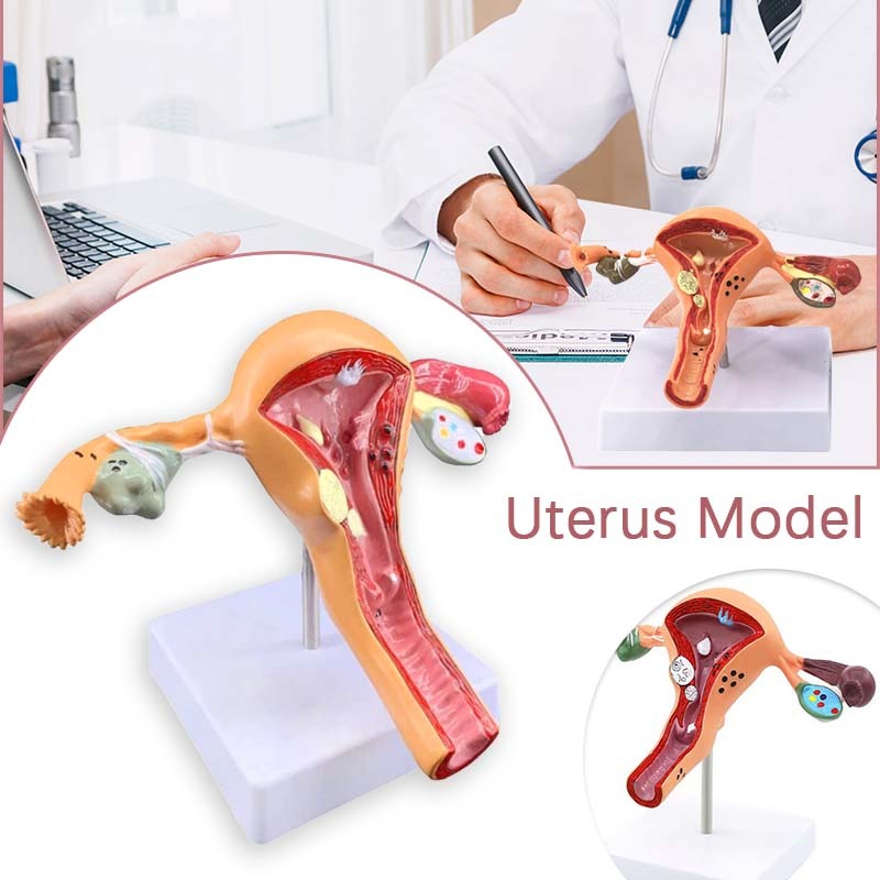 Manikin Uterus Ovary Model Patologis Uterus Alat Peraga Anatomi Anatomical Model Anatomy Uterus