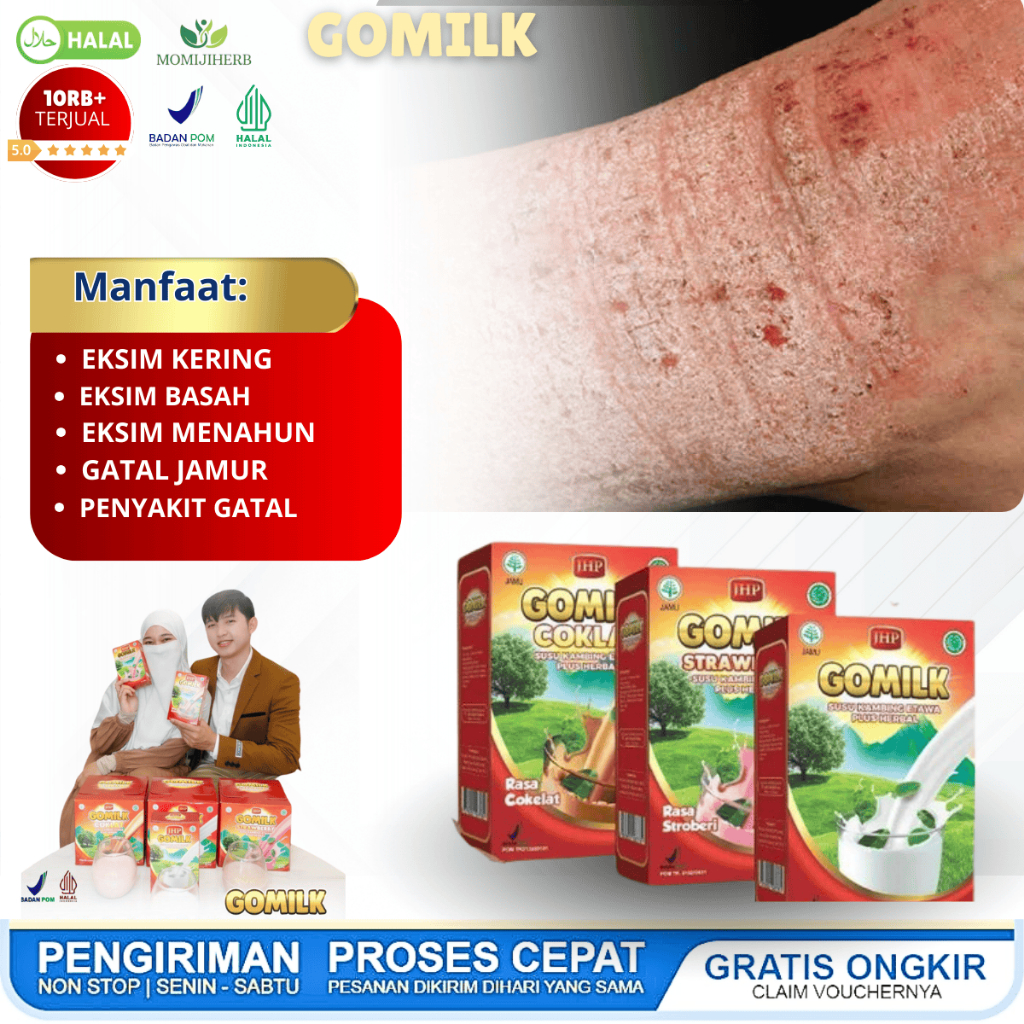 GOMILK Susu Kambing Etawa Plus Obat Herbal Eksim Menahun Eksim Kering Eksim Basah Salep Eksim Gatal 