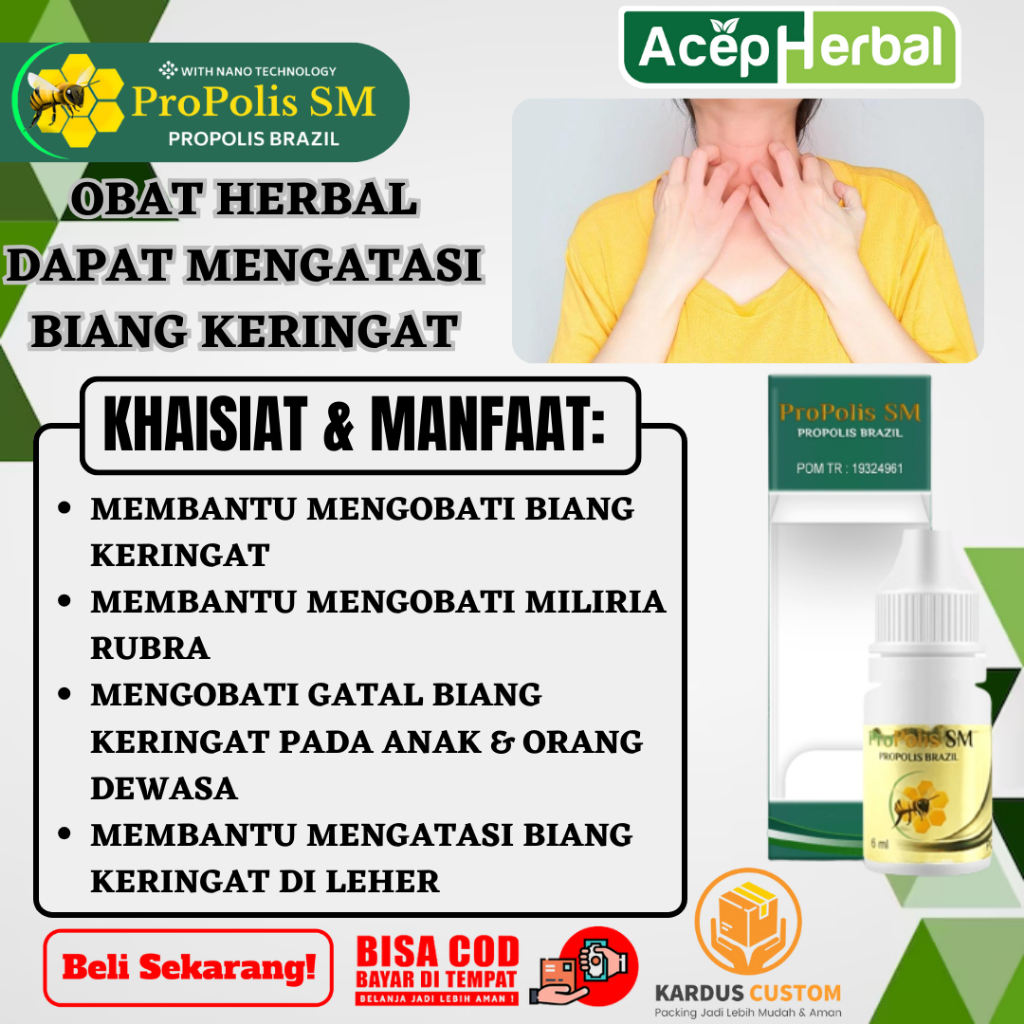 Obat Biang Keringat - Obat Miliaria Rubra, Obat Gatal Biang Keringat, Obat Biang Keringat Anak dan D