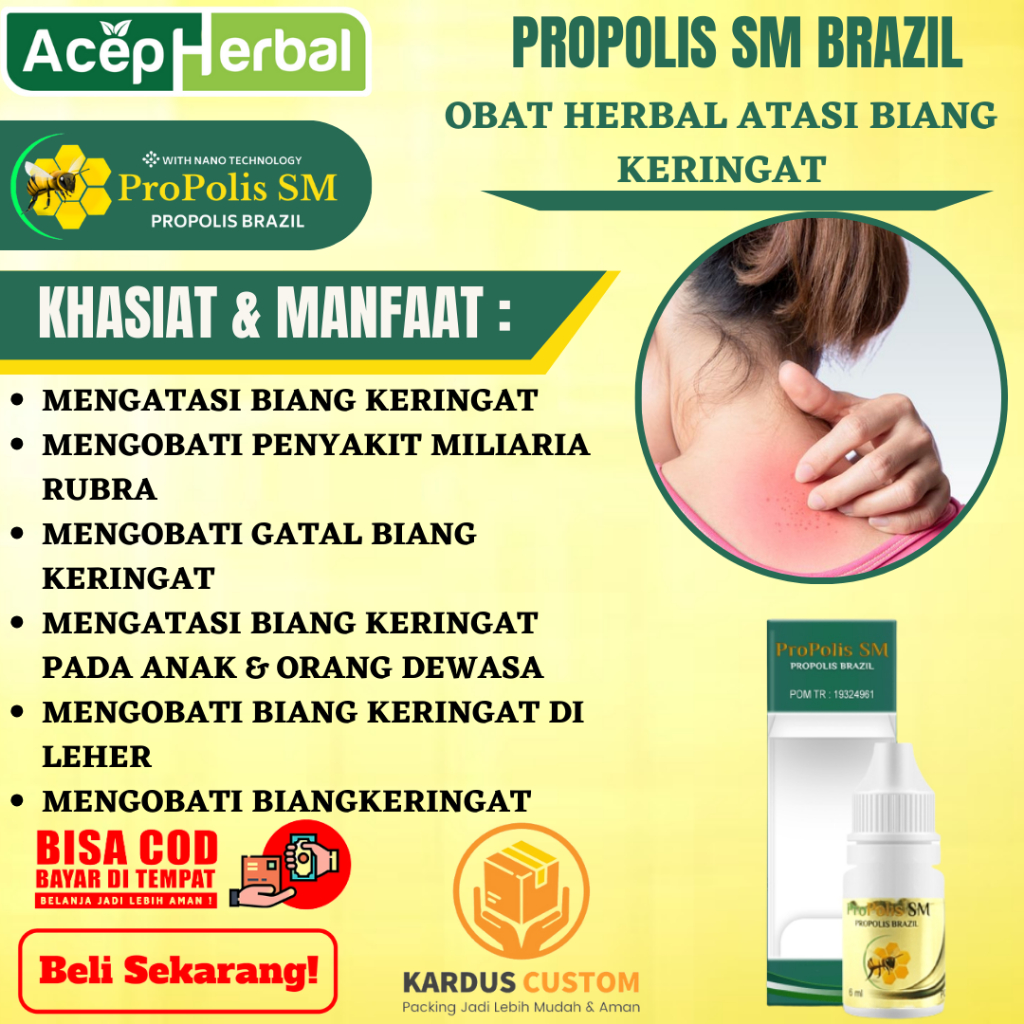 Obat Biang Keringat - Obat Miliaria Rubra, Obat Gatal Biang Keringat, Obat Biang Keringat Anak dan D