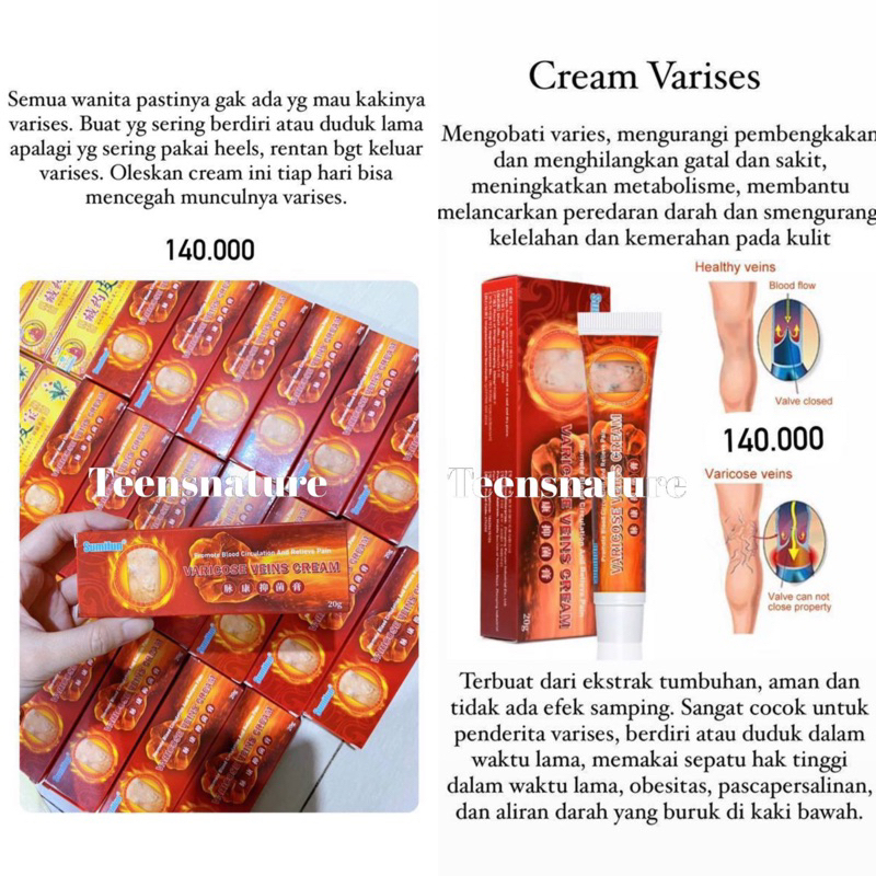 VARISES Cream Koyo Krim dan Koyo Penang untuk Varises Koyo PENANG DIJAMIN