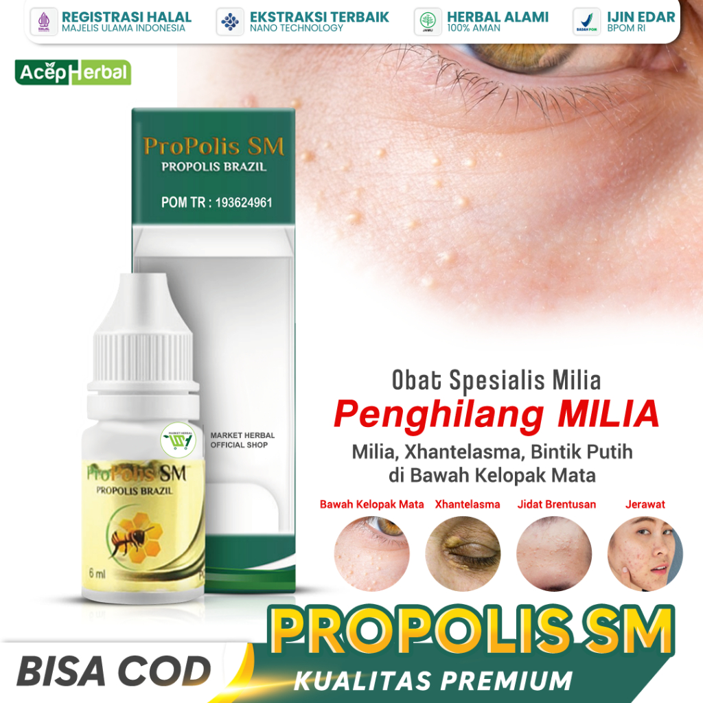 Obat Penghilang Milia Anak BPOM, Obat Bintik Putih di Milia Bawah Mata, Obat Milia pada Wajah, Obat 