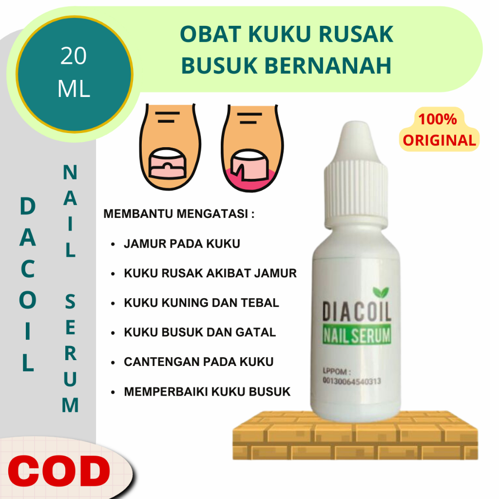 Obat Kuku Jamur dan Rusak Serum Kuku Rusak Cantengan Diacoil Nail Serum