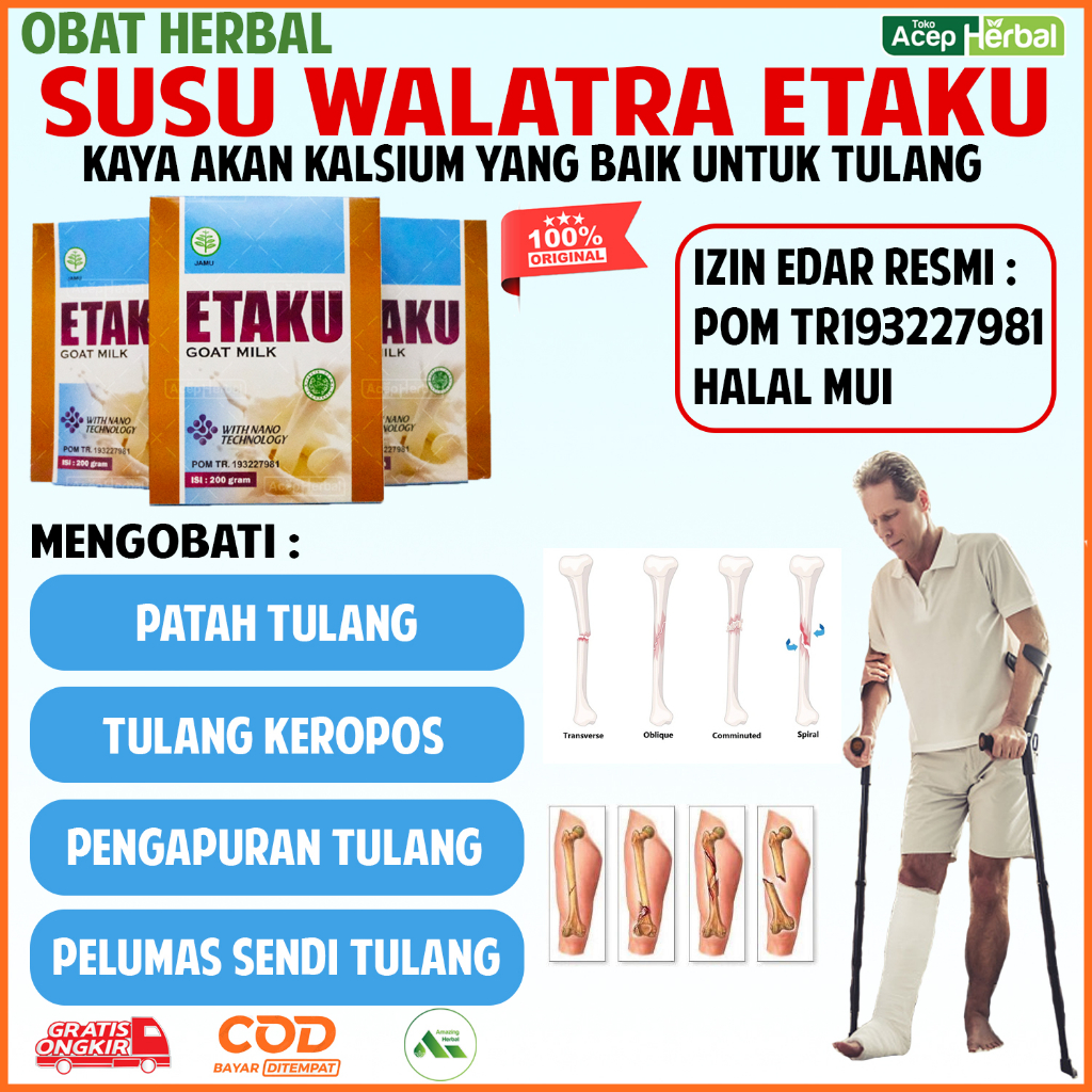 Susu Patah Tulang Dan Retak Kalsium Tulang Keropos Obat Untuk Pengapuran Tulang Osteoporosis Penguat