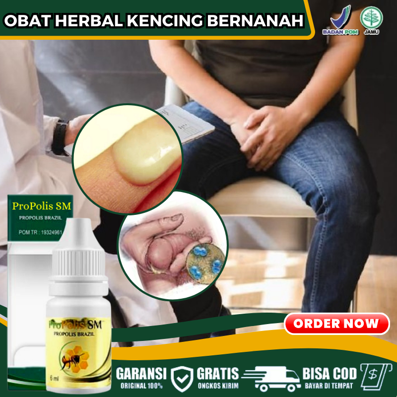 Obat Kencing Bernanah Herbal, Obat Sakit Gonore, Obat Infeksi Gonore, Obat Sifilis, Penyakit Kelamin