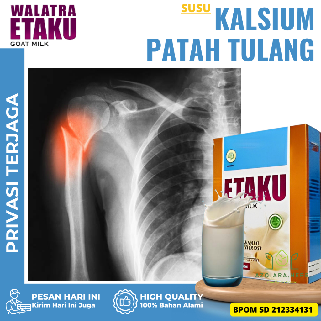 

Susu Kalsium Untuk Patah Tulang, Obat Penyembuh Patah Tulang, Obat Pengapuran Tulang, Susu Penambah Kalsium, Obat Tulang Retak, Obat Tulang Bergeser, Susu Sembuhkan Patah Tulang, Susu Kaki Lemah Sulit Berjalan - Walatra Susu Etaku