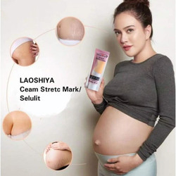 Laoshiya Penghilang Stretch Mark Original , Cream Penghilang Stretch Mark, Cream Penghilang Kerutan 