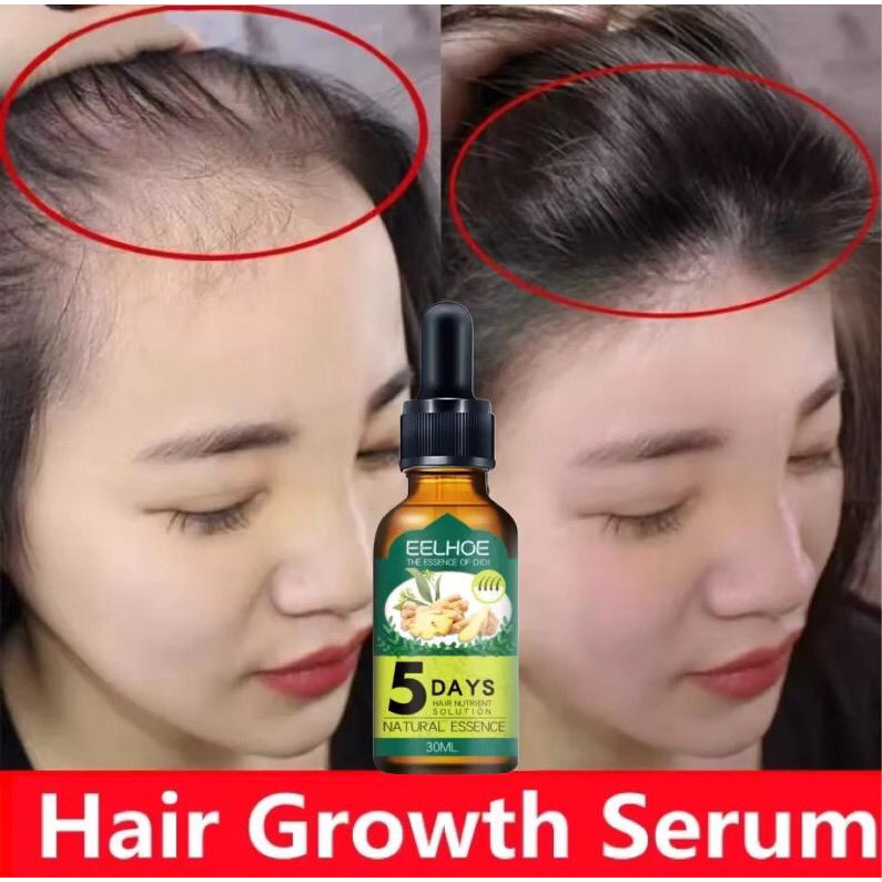 Hair Care Hair Growth Serum Essential Oils Essence Hair Loss Liquid Health Care Beauty Dense Hair Gr