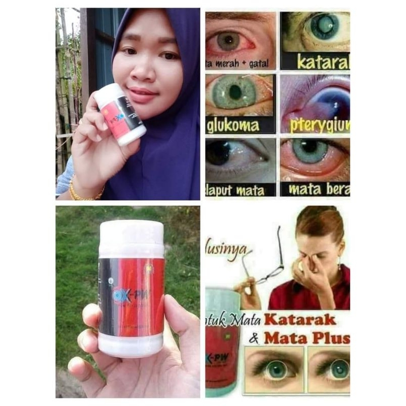 

OXPW NASA I MATA KATARAK I MINUS I PLUS I SILINDER