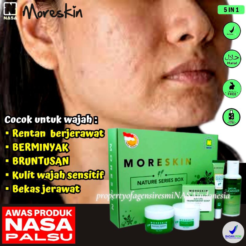 Paket Skincare Wajah Bruntusan Kulit Berjerawat Noda Flek Hitam Bekas Jerawat BPOM Ampuh Moreskin Na