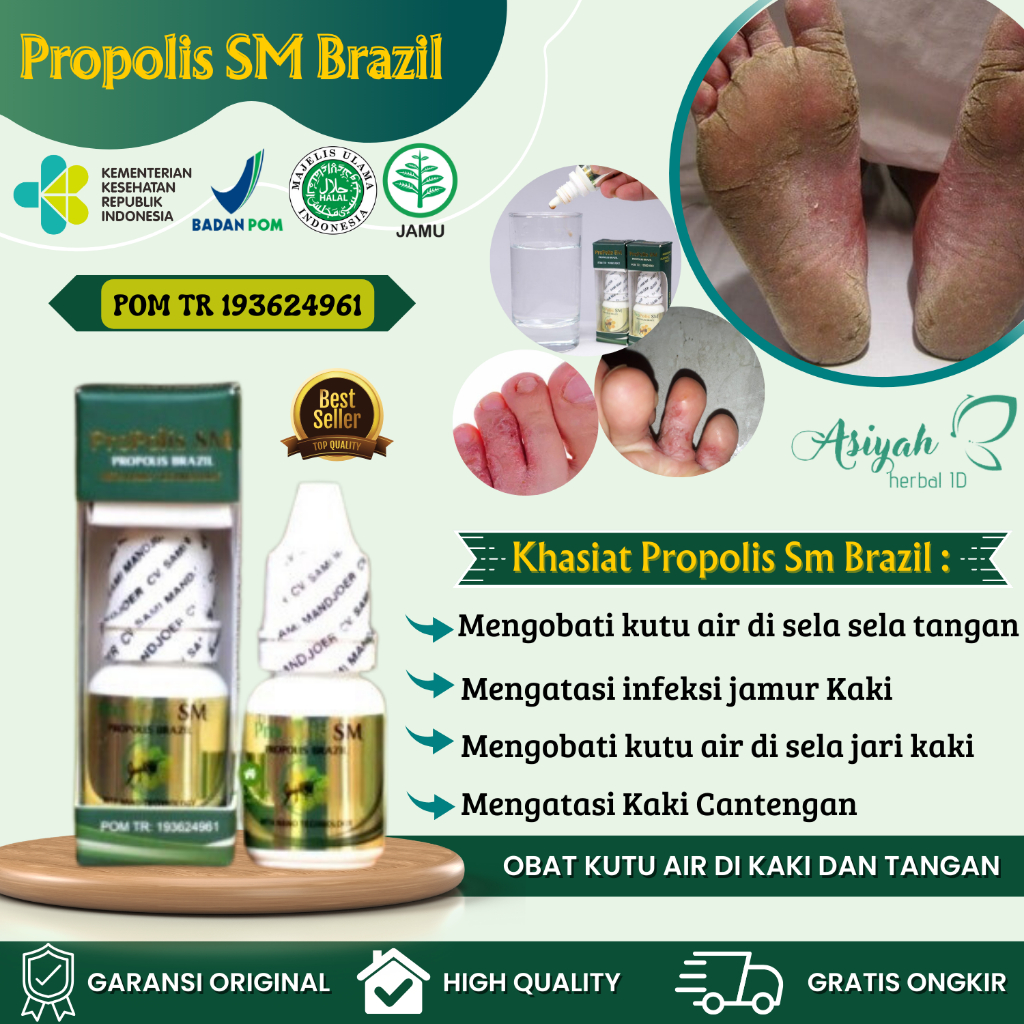 Propolis Sm Brazil Obat Tradisional Untuk Kutu Air Di Sela Kaki, Obat Kutu Air Kaki, Obat Kutu Air D