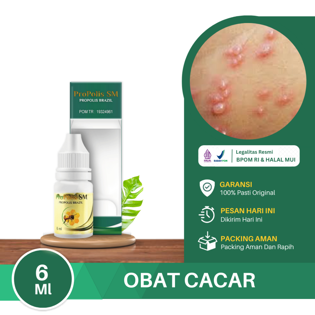 Obat Cacar Air, Cacar Air Cepat Kering, Cacar Monyet, Penghilang Cacar Ular, Cacar Bisul, Penghilang
