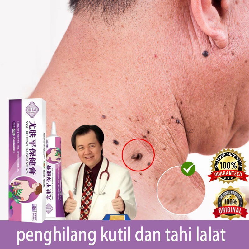 Obat penghilang kutil penghilang kutil dan tahi lalat penghilang tahi lalat salep kutil 20g Obat Pen