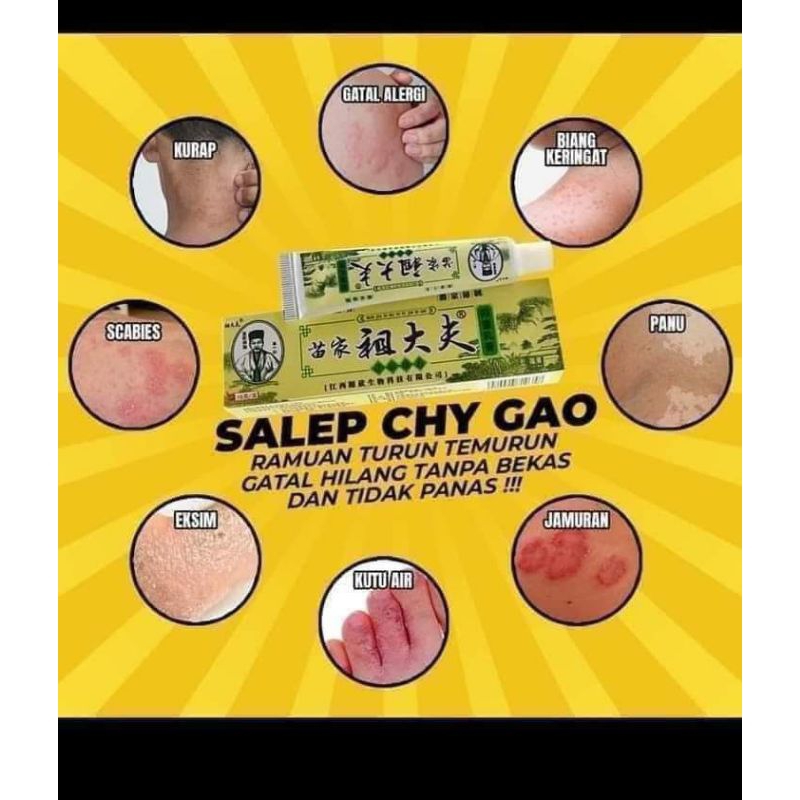 salep gatal chy gao