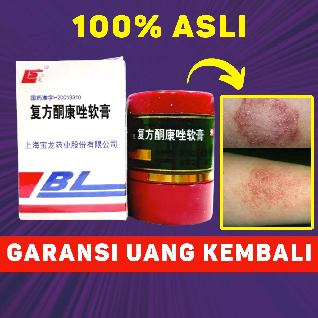 Salep BL / Salep Gatal / Cream BL Original 100% Salap Gatal Saleb Gatal China Original Salep Luka Or