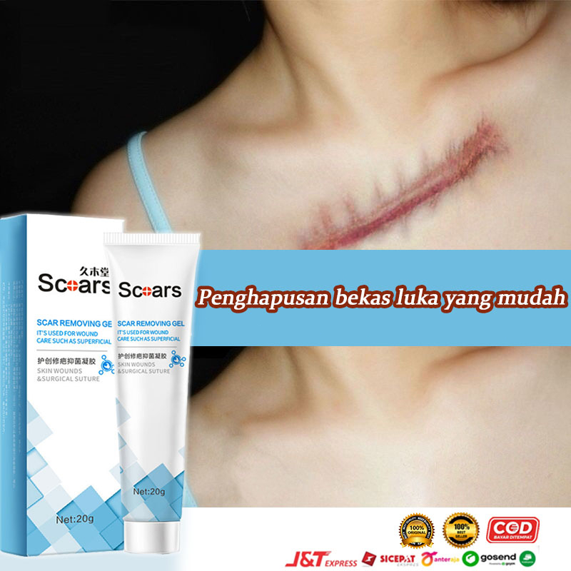 SCAR CREAM Gel Penghilang Bekas Luka Krim Penghilang Bekas Luka Jerawat Stretch Mark Menghilangkan B