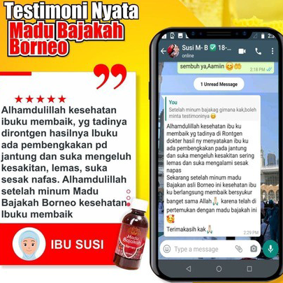 

Terlaris Madu Bajakah Borneo [ORIGINAL 1000%] - Herbal Kanker Tumor Benjolan Kelenjar Asam Lambung dan Segala Kronis BA by Teuku Wisnu Diskon