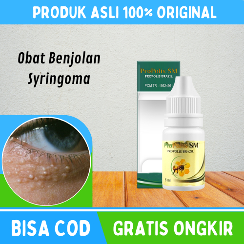 Obat Syringoma, Penghilang Syringoma, Obat Gumpalan Lemak Di Kelopak Mata, Salep Oles Untuk Menghila
