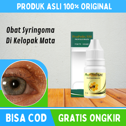 Obat Syringoma, Obat Syringoma Pada Wajah, Obat Milia Di Bawah Mata, Obat Milia Di Kelopak Mata, Oba