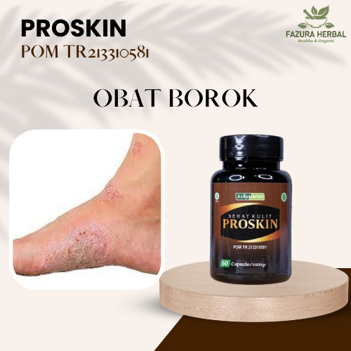 Obat Borok, Obat Borok Bernanah, Obat Borok Berdarah, Obat Penghilang Bekas Borok, Obat Borok Pada T