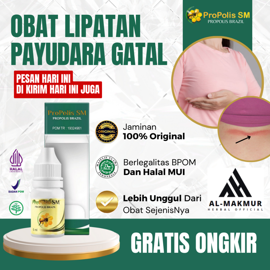 Obat Lipatan Payudara Gatal, Obat Ruam Merah Payudara, Obat Iritasi Kulit, Obat Jamur Lipatan Payuda