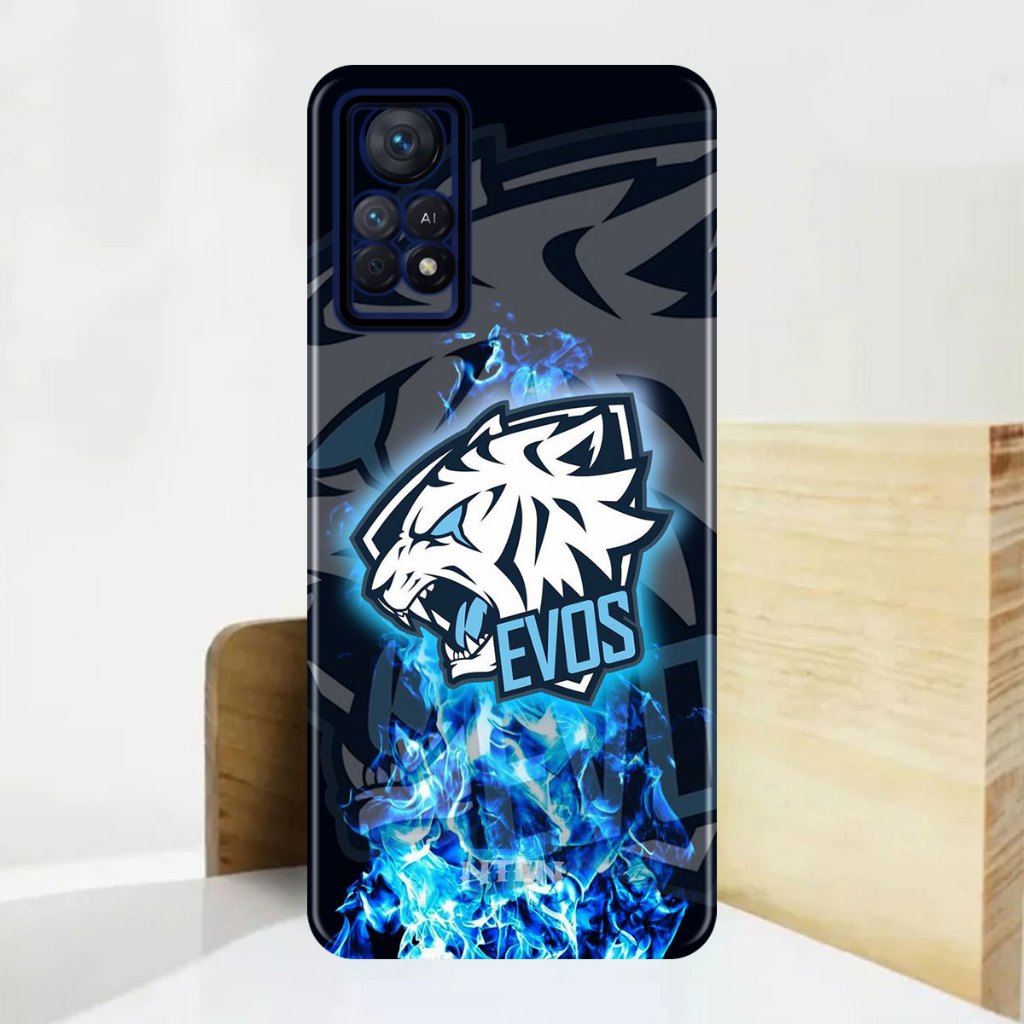 Case REDMI NOTE 11 Casin g Hp - Softcase Case  REDMI NOTE 11 Casing Hp - Softcase - Case Hp  REDMI N