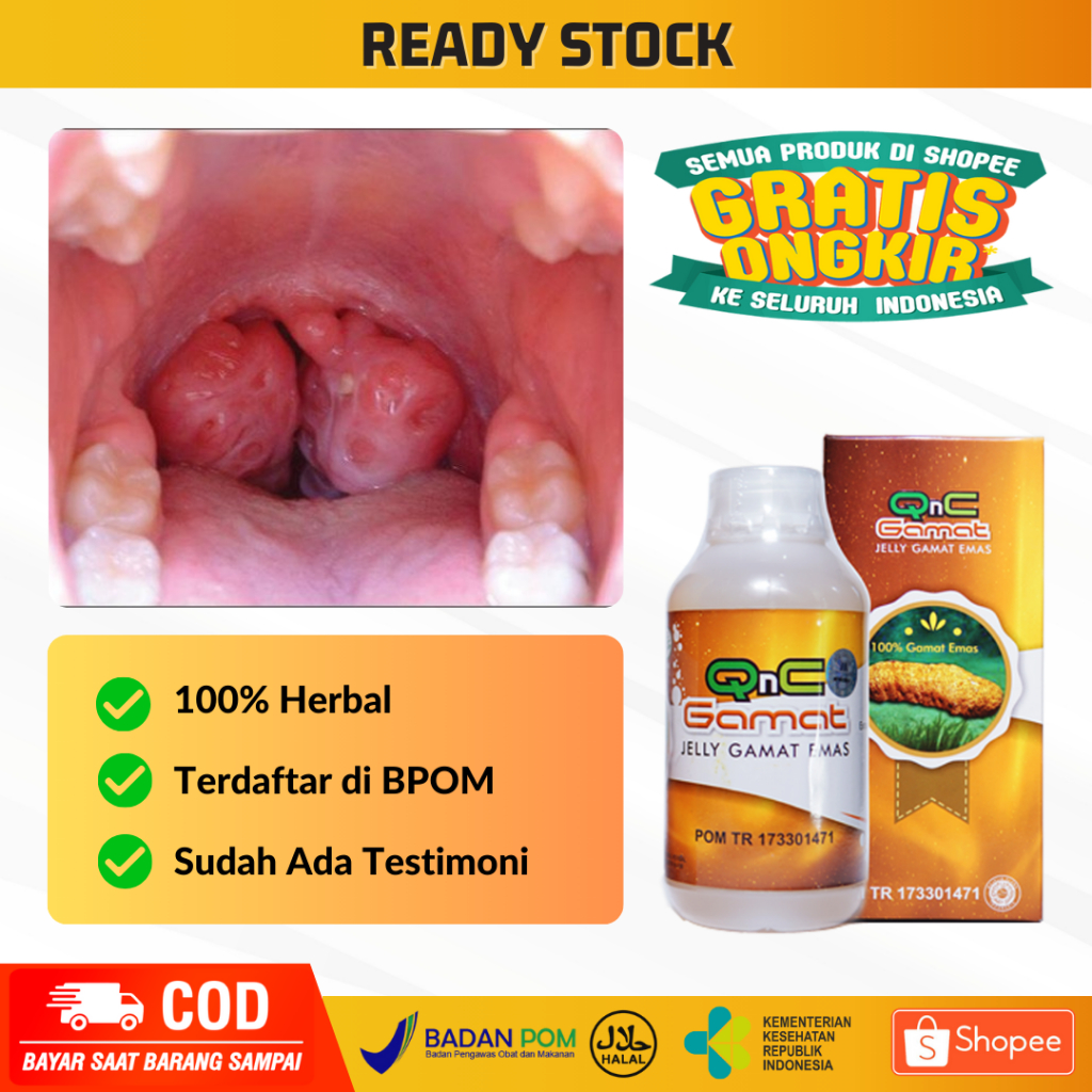 Obat Amandel Anak Dewasa, Obat Radang Amandel, Obat Amandel Bengkak, Obat Radang Amandel, Obat Sakit