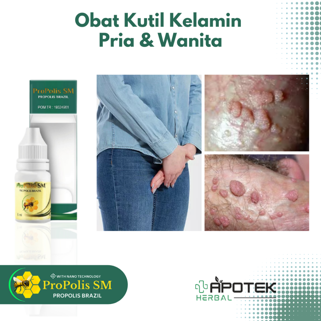 Obat Kutil Kelamin Pria dan Wanita HPV Gatal Penis Gatal Miss V Herpes Genital Bintik Putih di Kemal