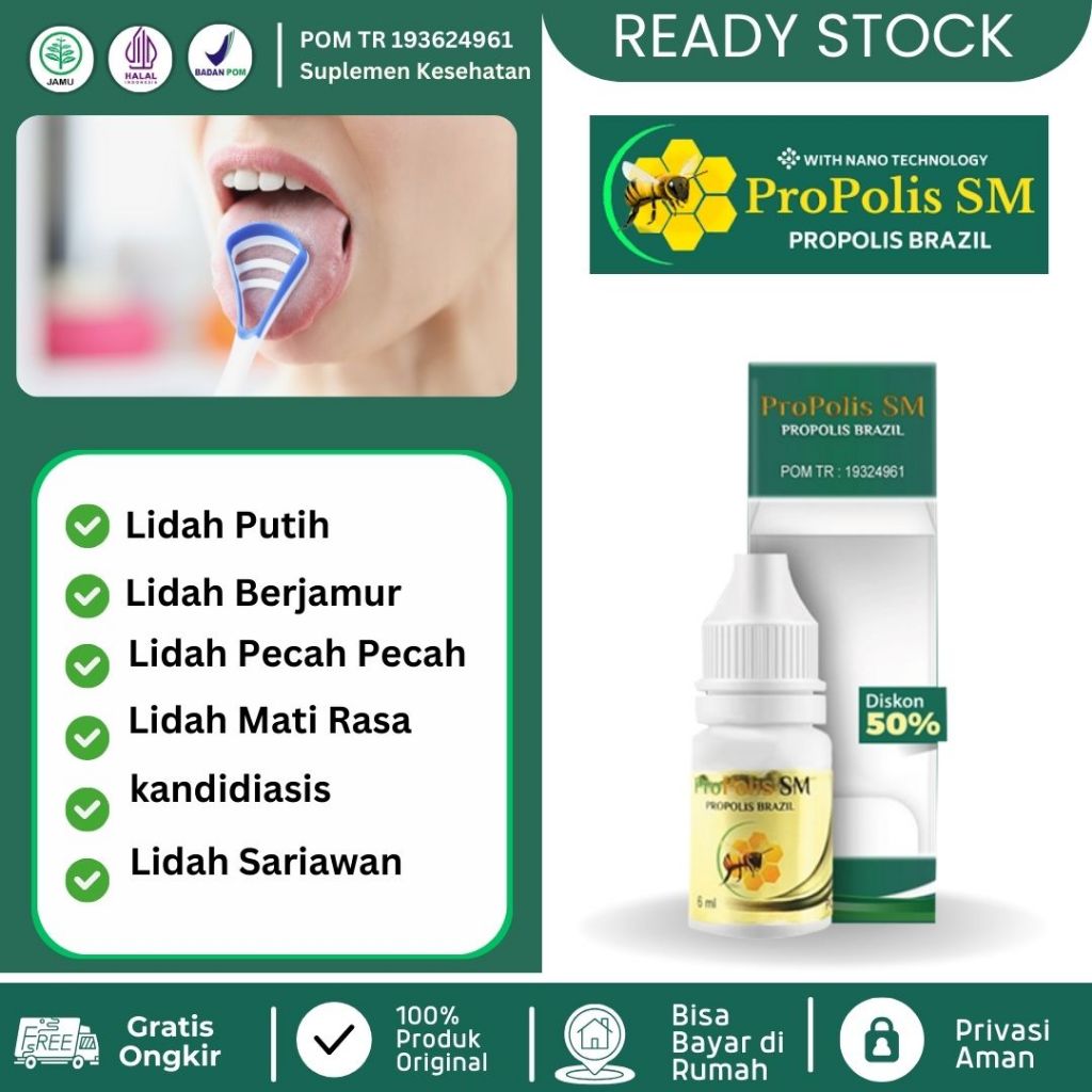 Obat Lidah Putih Obat Lidah Putih Berjamur Obat kandidiasis Lidah Pecah Pecah Lidah Mati Rasa Lidah 