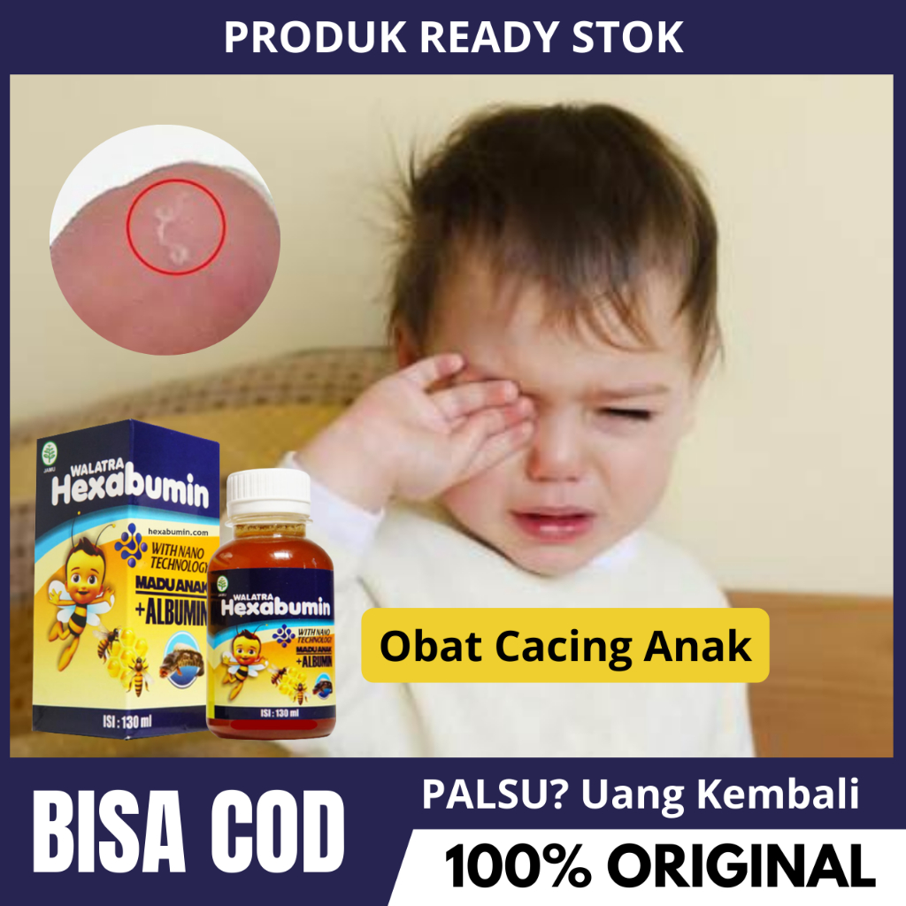 Obat Cacing Anak, Obat Cacingan Anak, Cacing Kremi, Anus Anak Gatal, Perut Kembung Dan Bengkak Pada 