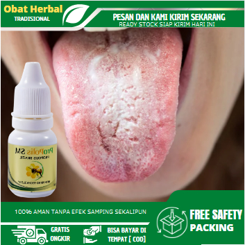 Obat Kandidiasis Mukokutan, Obat Lidah Putih Berjamur, Obat Radang Lidah Putih, Obat Lidah Terasa Pa