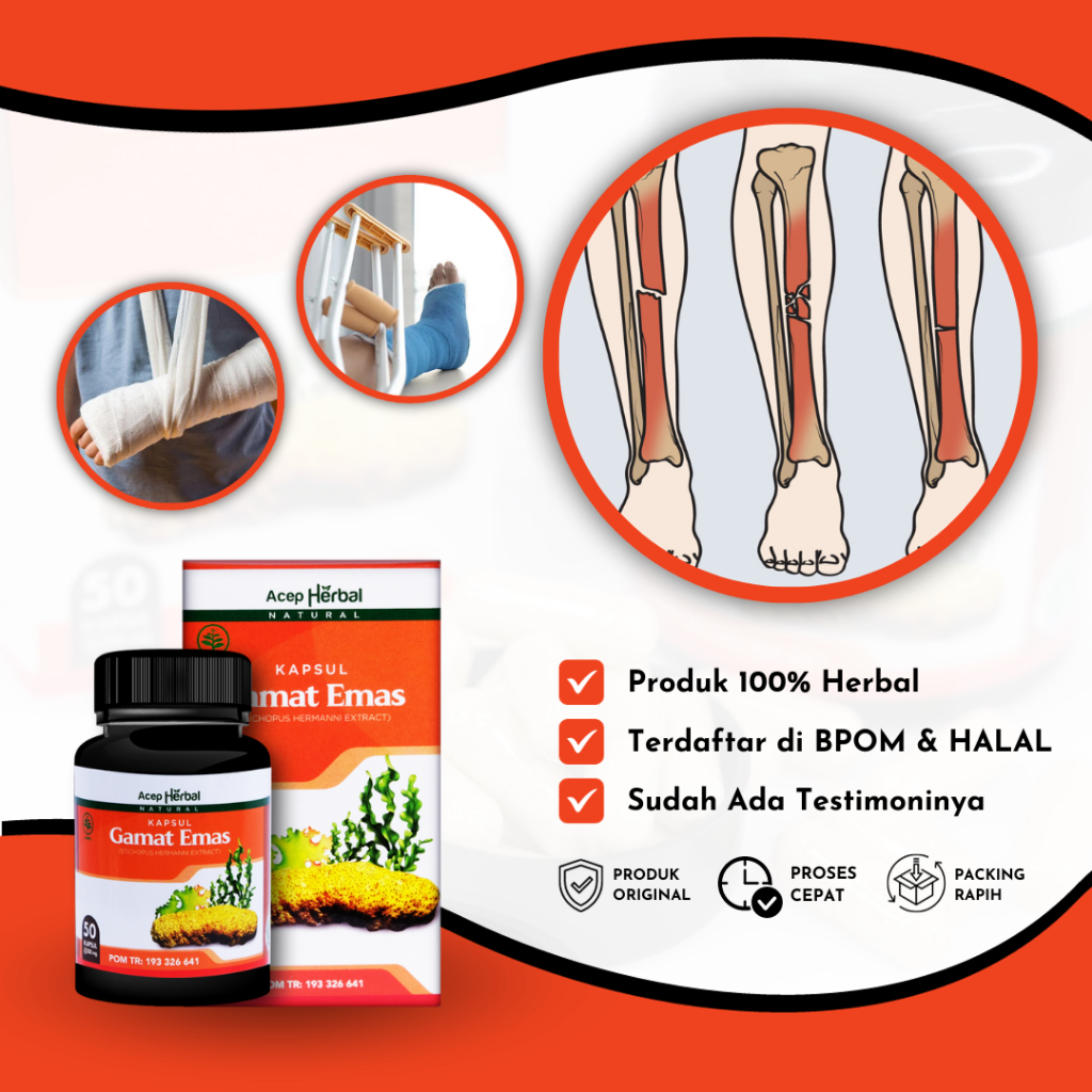 Obat Patah Tulang dan Retak, Obat Patah Tulang Kaki, Obat Patah Tangan, Obat Patah Tulang Rusuk, Oba