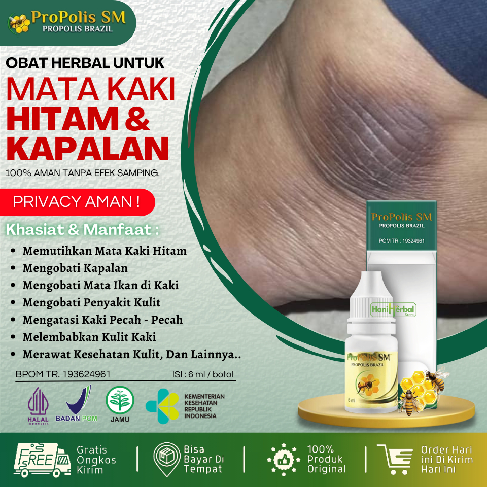 Obat Untuk Mata Kaki Hitam, Pemutih Mata Kaki Yang Hitam, Obat Kaki Kapalan, Mata Kaki Hitam & Kasar