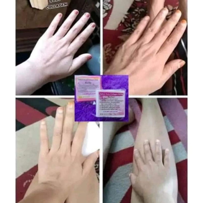 SABUN PEMUTIH BADAN SABUN PENGHILANG BEKAS KORENG SABUN COLLAGEN VIRAL
