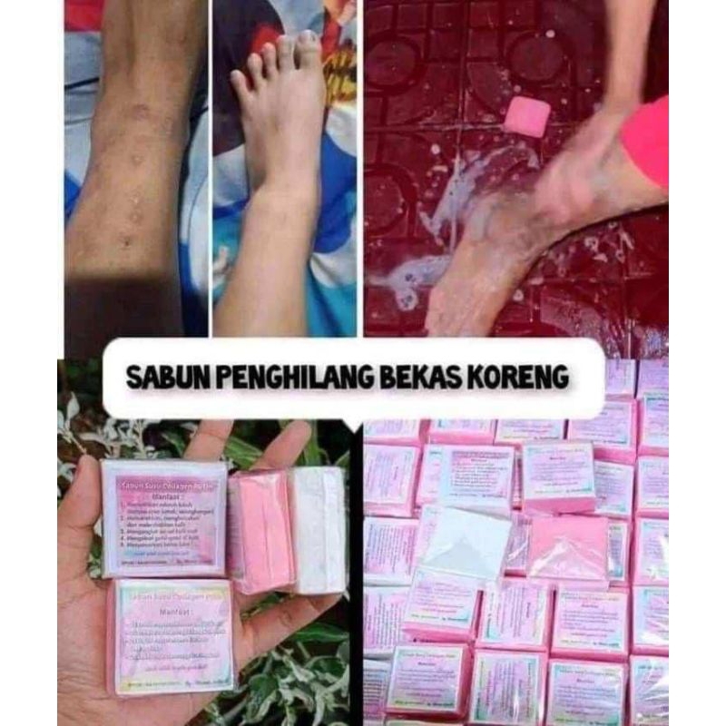 sabun susu collagen pemutih badan (memudarkan koreng dan bekas luka)