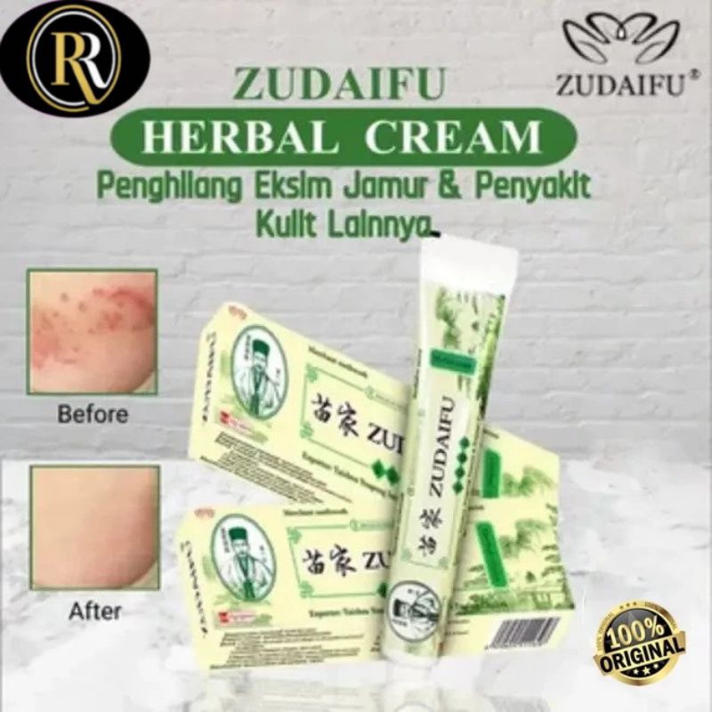 Salep Gatal Kulit Zudaifu Super Ampuh Obat Gatal Herbal Cina Original