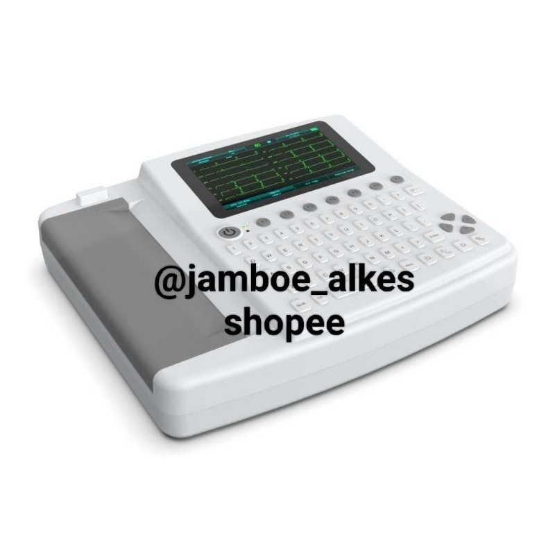 EKG/ECG 12 Channel with Interpretation