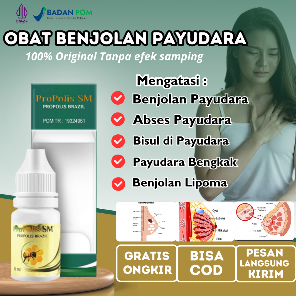 Penghancur Benjolan Tumor Payudara, Pengempis Benjolan Payudara Tumor Payudara, Obat Benjolan Lipoma