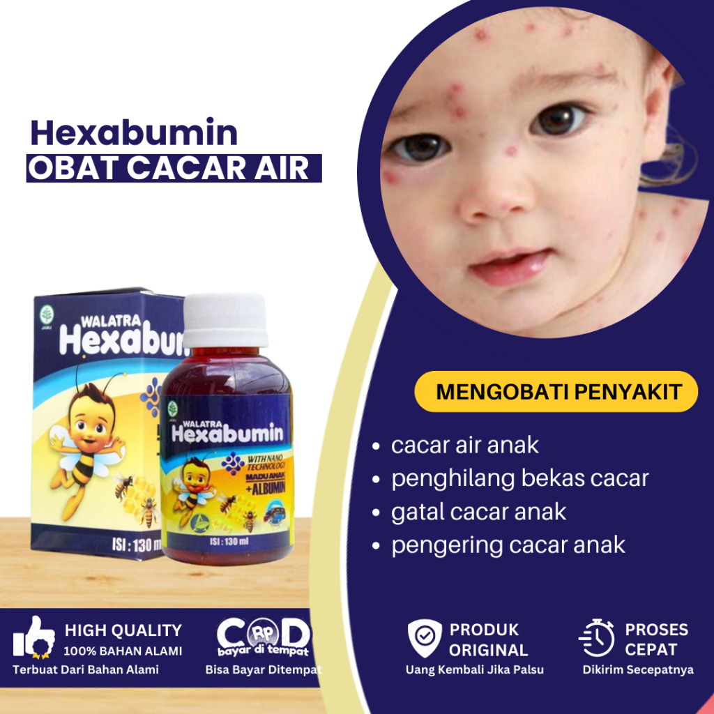 Obat Cacar Air Anak, Penghilang Bekas Luka Cacar, Obat Cacar Air Bernanah, Obat Penghilang Gatal Cac