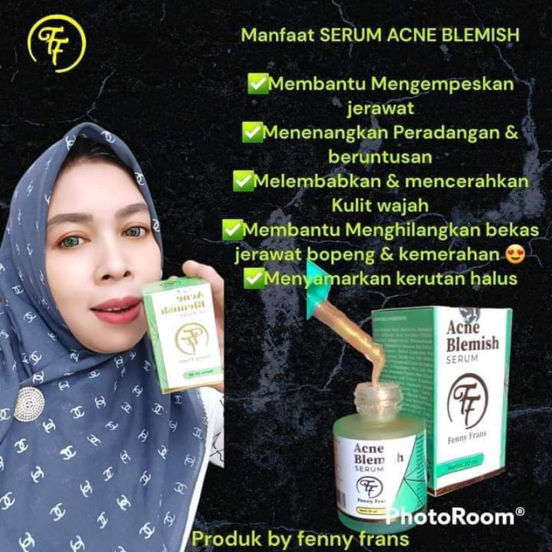 serum acne blemish FF ORI BPOM by Fenny frans