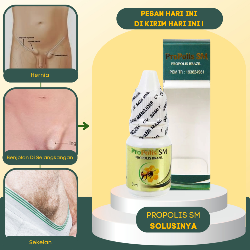 Obat Benjolan Lipoma - Obat Penghilang Benjolan di Selangkangan - Obat Benjolan Selangkangan - Obat 