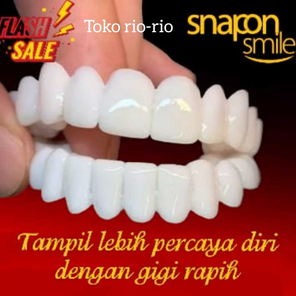 Snap On Smile Venner Gigi Palsu 1 SET (ATAS &amp; BAWAH) Gigi Palsu Silikon ORIGINAL