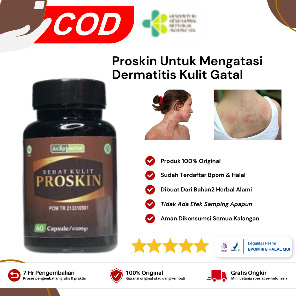 Proskin Obat Dermatitis Seboroik, Dermatitis Kontak, Dermatitis Perioral, Dermatitis Atopik, Dermati