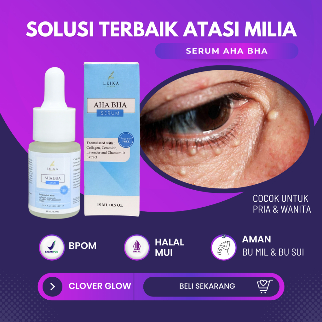 Obat milia di bawah mata penghilang milia paling ampuh serum aha bha Leika Skincare serum milia remo