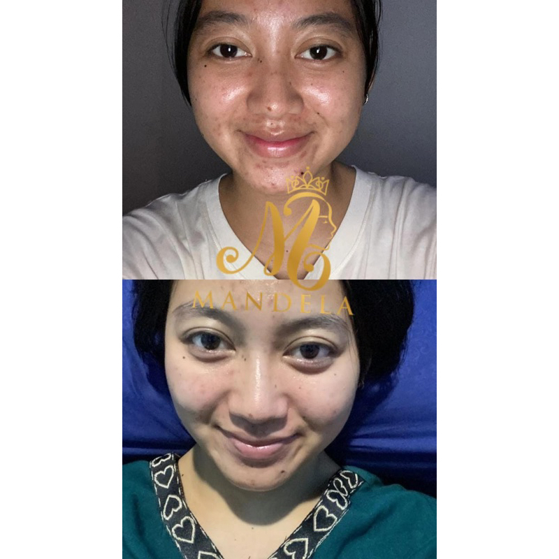 MBC SKINCARE