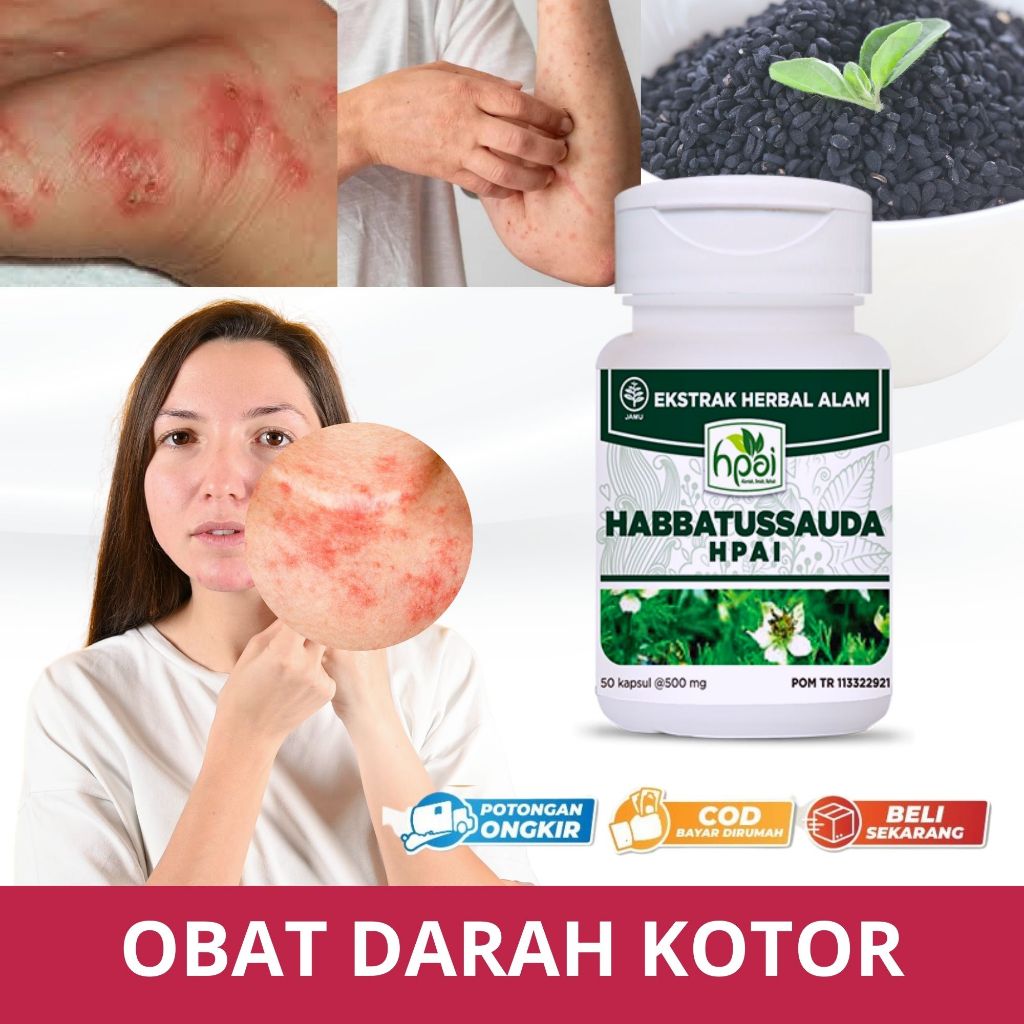 Obat Darah Kotor Dan Alergi Gatal Gatal Membersihkan Jerawat Darah Manis Prurigo