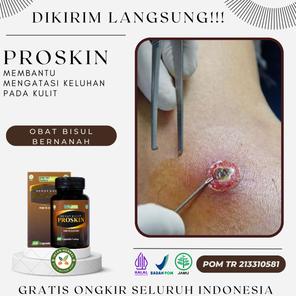 Proskin 100% Original - Obat Bisul, Bisul Bernanah, Bisul Di Kepala, Bisul Di Pantat, Bisul Di Area 