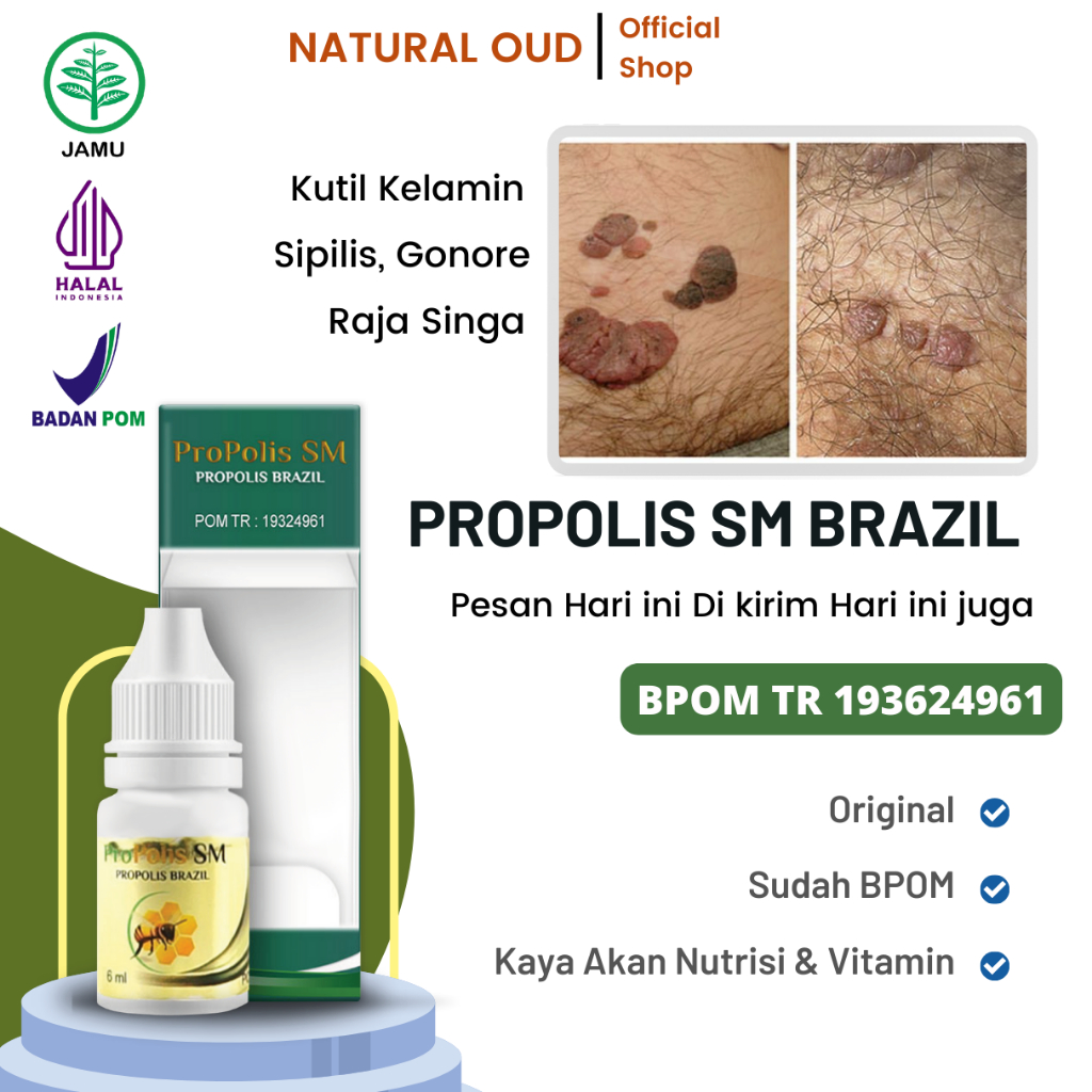 Obat Kutil Kelamin Pria Wanita Sipilis Raja Singa Gonore Perontok Kutil Kelamin Propolis Sm