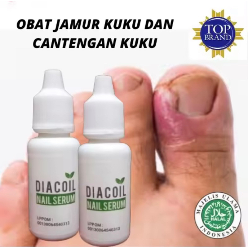 DIACOIL PENGHILANG JAMUR KUKU DAN OBAT KUKU CANTENGAN ORIGINAL