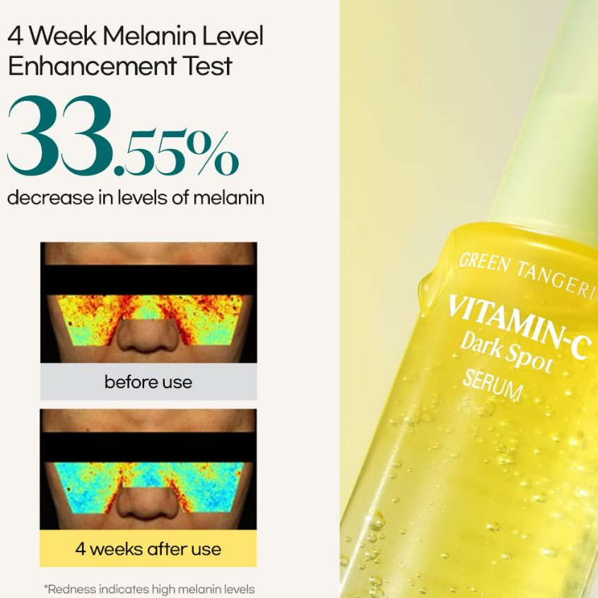 Goodal Green Tangerine Vitamin C Serum 40ml /Dark Spot Treatment for Sensitive Skin Care /Goodal Vi 